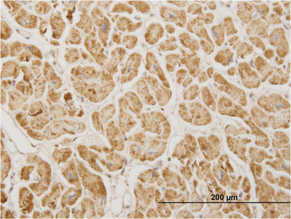 NDUFA5 Antibody (OAAL00210) in Formalin-fixed paraffin-embedded human heart using Immunohistochemistry
