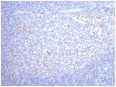 CD68 Mouse Monoclonal Antibody