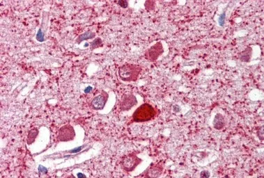 Parvalbumin antibody, C-term