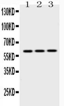 Cytokeratin 14/KRT14 Antibody 