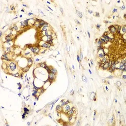 Ribophorin I antibody