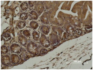 α-Smooth Muscle Actin Mouse Mo