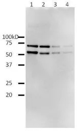 HIV1 Reverse transcriptase ant