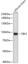 NAK / TBK1 antibody