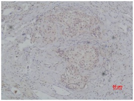 PI3 Kinase P85β Rabbit Polyclo