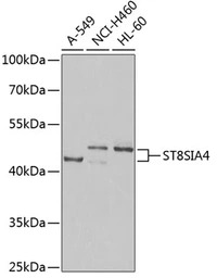 ST8SIA4 antibody