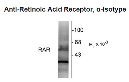 Anti-Retinoic Acid Receptor, Alpha-Isotype (OAPC00018) in Rat hippocampal homogenate using Western Blot