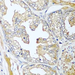 Complement Factor D antibody