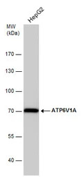 ATP6V1A antibody [GT3846]