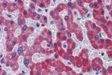 SCD antibody, C-term