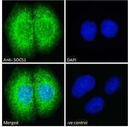 SOCS1 antibody, C-term