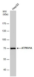 ATP6V1A antibody [GT811]