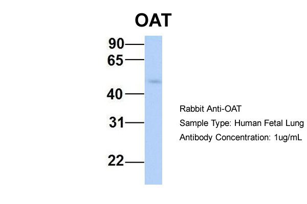 OAT antibody - middle region (ARP48134_P050) in Hum. Fetal Lung using Western Blot