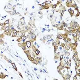 PPOX antibody