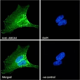 ABCA4 antibody, C-term