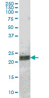 ATF3 Antibody (OAAL00018) in Hela S3 NE using Western Blot