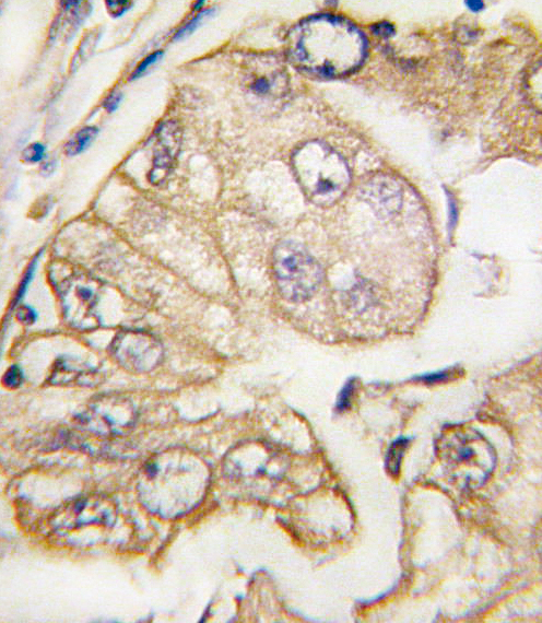 VGFR3 antibody (OAAB07216) in Human Lung using Immunohistochemistry