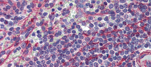 MCTP1 antibody - middle region (ARP44441_P050) in Human Spleen using Immunohistochemistry
