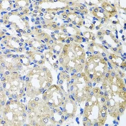ST8SIA2 antibody