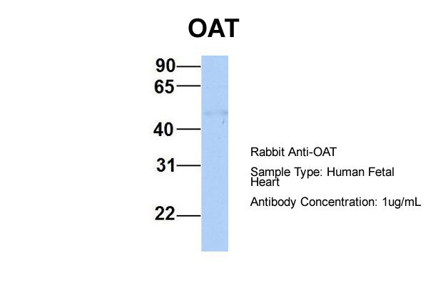OAT antibody - middle region (ARP48134_P050) in Hum. Fetal Heart using Western Blot