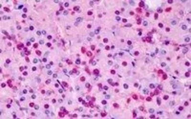 Triosephosphate isomerase anti