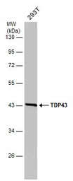 TDP43 antibody [GT6310]