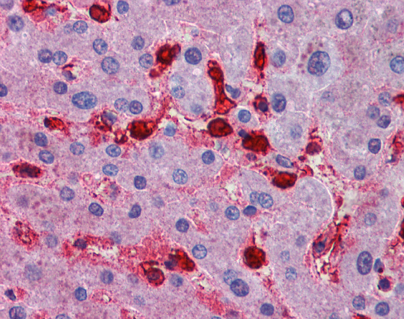 MAP4K4 antibody - N-terminal region (ARP49031_P050) in Human Liver using Immunohistochemistry