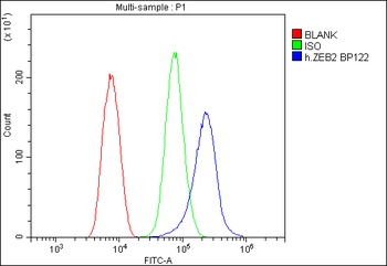 Smad Interacting Protein 1/ZEB