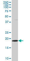 SKP1 Antibody (OAAL00303) in HeLa using Western Blot