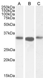 ARPC2 antibody, C-term