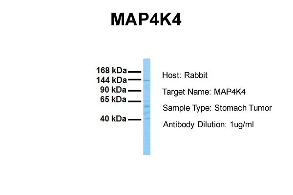 MAP4K4 antibody - N-terminal region (ARP49031_P050) in Human Stomach Tumor using Western Blot