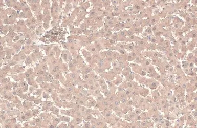 ATP6V1A antibody [GT811]