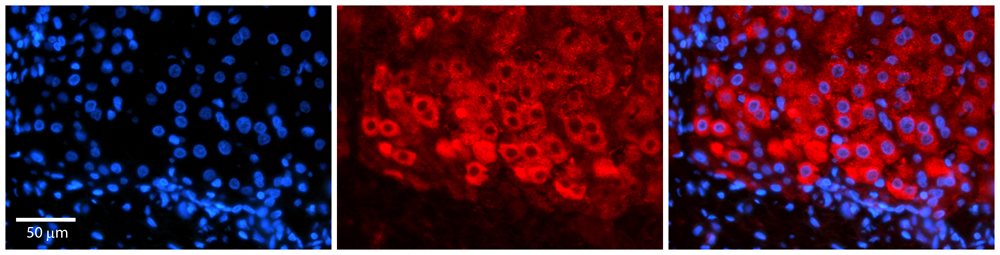 CSF1 antibody - N-terminal region (ARP44329_P050) in liver using Immunohistochemistry.