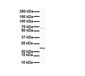 SLC27A4 antibody - middle region (ARP43901_P050) in Human MCF7 using Western Blot