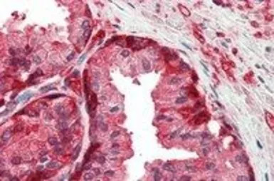 GSTP1 antibody, Internal