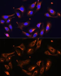 Melanophilin antibody