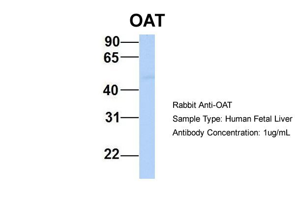 OAT antibody - middle region (ARP48134_P050) in Hum. Fetal Liver using Western Blot