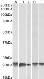 Ferritin Light Chain antibody,