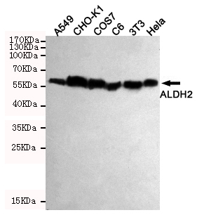 ALDH2 Antibody (OAAB20858) in Hela Cells, 3T3 Cells, C6 Cells, COS7 Cells, CHO-K1 Cells, A549 Cells using Western Blot