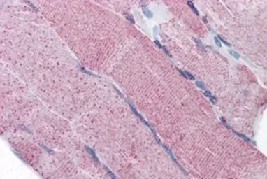 PACE4 antibody, Internal