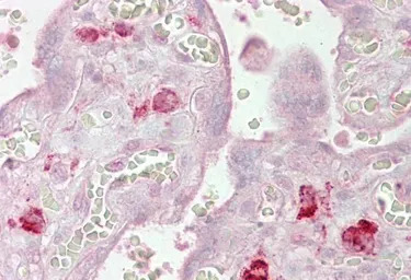 AGO1 antibody, Internal