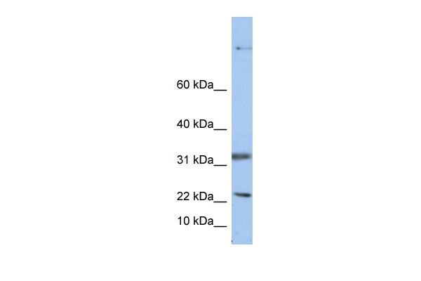 SEP15 antibody - middle region (ARP48247_P050) in Human HepG2 using Western Blot