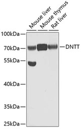 TdT antibody