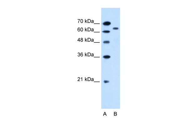 SLC22A3 antibody - N-terminal region (ARP44026_P050) in Human HepG2 using Western Blot