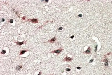 DYX1C1 (Isoform a) antibody, C