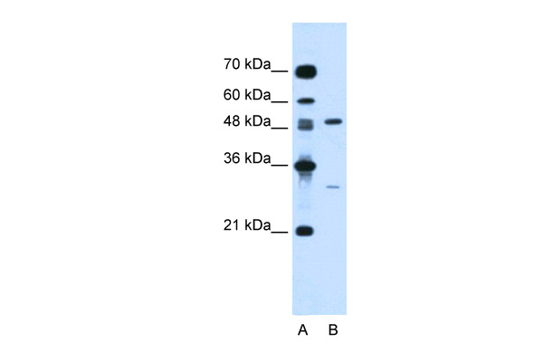 CSF1 antibody - N-terminal region (ARP44329_P050) in Human Jurkat using Western Blot