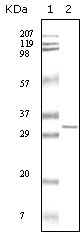SARS-M Antibody (OAEC04253) in SARS-mpm recombinant protein using Western Blot