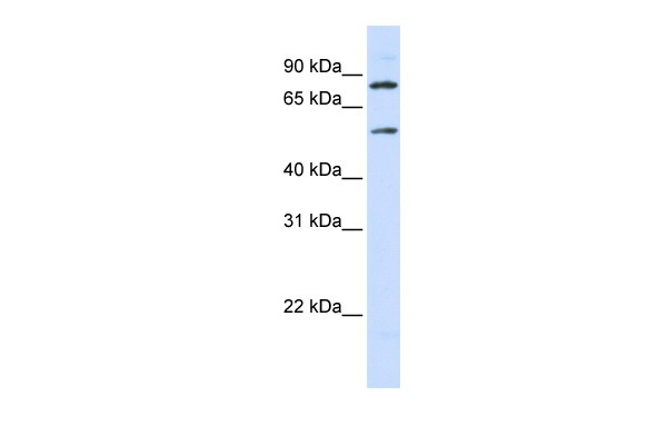 SLC27A4 antibody - middle region (ARP43901_P050) in Human 293T using Western Blot