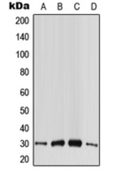 CABP4 antibody