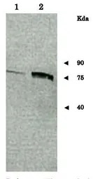Sup35 / PSI+ (S. cerevisiae) a